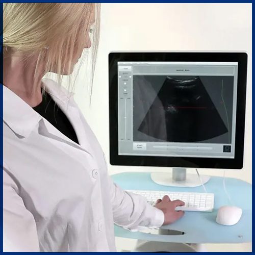 ECHOSTATION Densitometría Ósea - Imagen 4